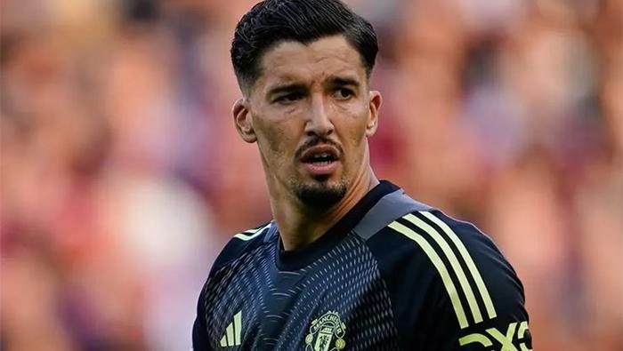 Altay Bayındır Manchester United'dan ayrılacak mı? Resmen açıkladı... 6 altay bayindir manchester uniteddan ayrilacak mi resmen acikladi 4