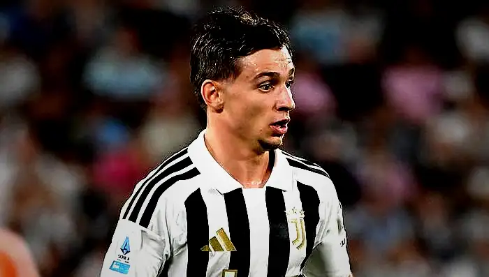 juventus karisti oyundan cikti yumruk atti 2 6ds9Kk5J